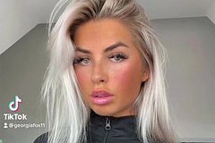 Лицо блогерши окаменело после процедуры у косметолога: Внешний вид: Ценности: Lenta.ru0
