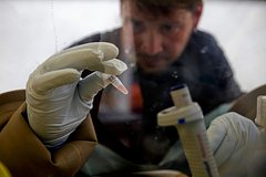 Найден эффективный биомаркер одного из самых смертельных видов рака: Здоровье: Наука и техника: Lenta.ru0