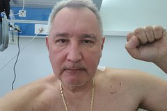 Раненый при обстреле в Донецке Рогозин поделился первым фото после операции: Политика: Россия: Lenta.ru0