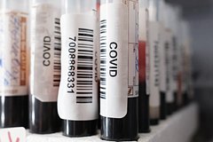 Раскрыта история названий вариантов COVID-19 «кентавр», «цербер», «грифон»: Общество: Россия: Lenta.ru0