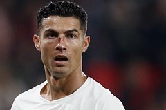 Роналду разбили лицо в матче Лиги наций: Футбол: Спорт: Lenta.ru0
